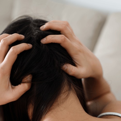 Simple home remedies for a healthy scalp