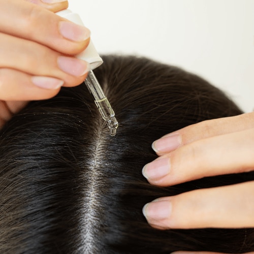 Say Goodbye To A Flaky Scalp: Best Home Remedies For Dandruff Treatment