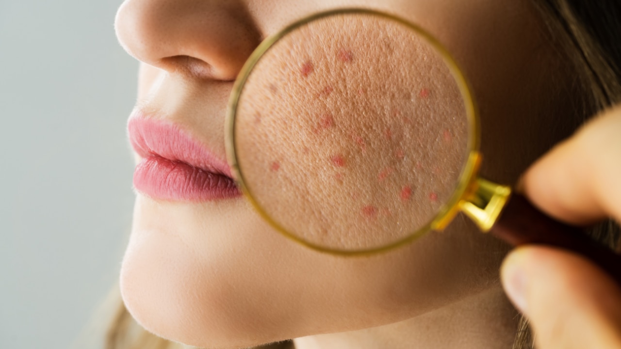 Consult a dermatologist for persistent skin issue