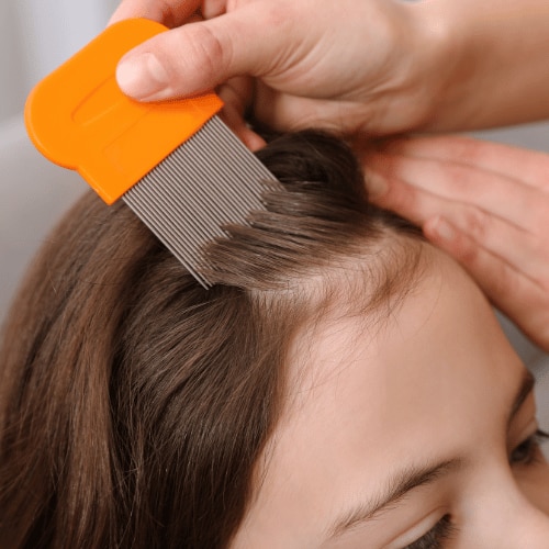 How to treat lice on hair naturally