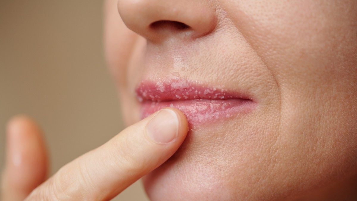 Aids in lip care