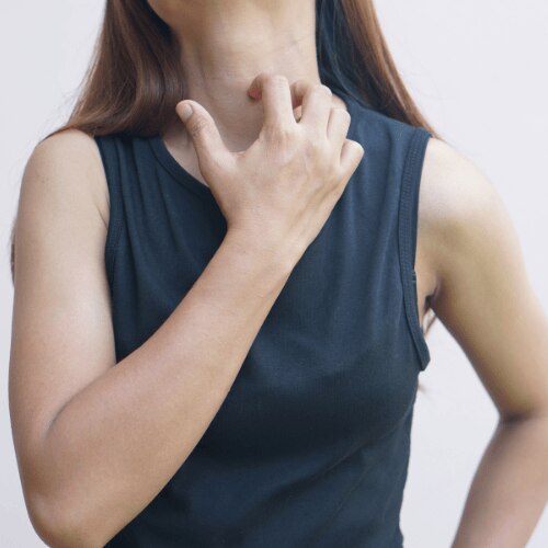 7 Home Remedies for Itchy Skin That Actually Work
