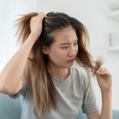 Hormonal Imbalance Skin Issues: 5 Warning Signs You Shouldn't Ignore