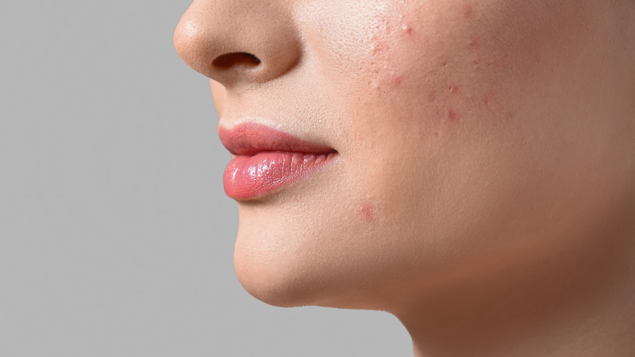 Causes of Itchy Face