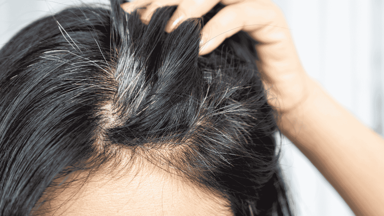 5. Prevents greying