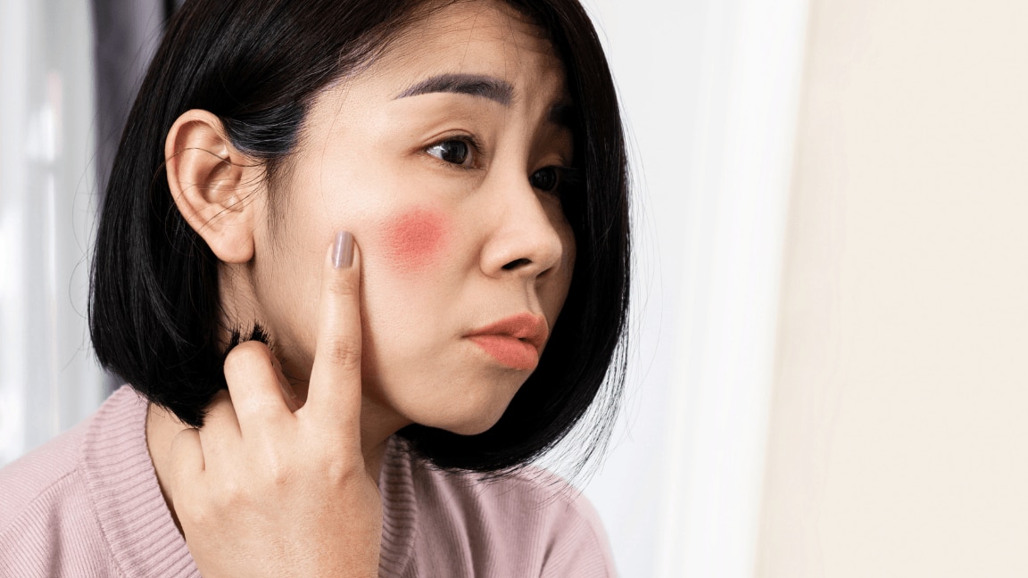 An Expert Explains Why You Could Have An Itchy Face And  WHAT TO DO ABOUT IT