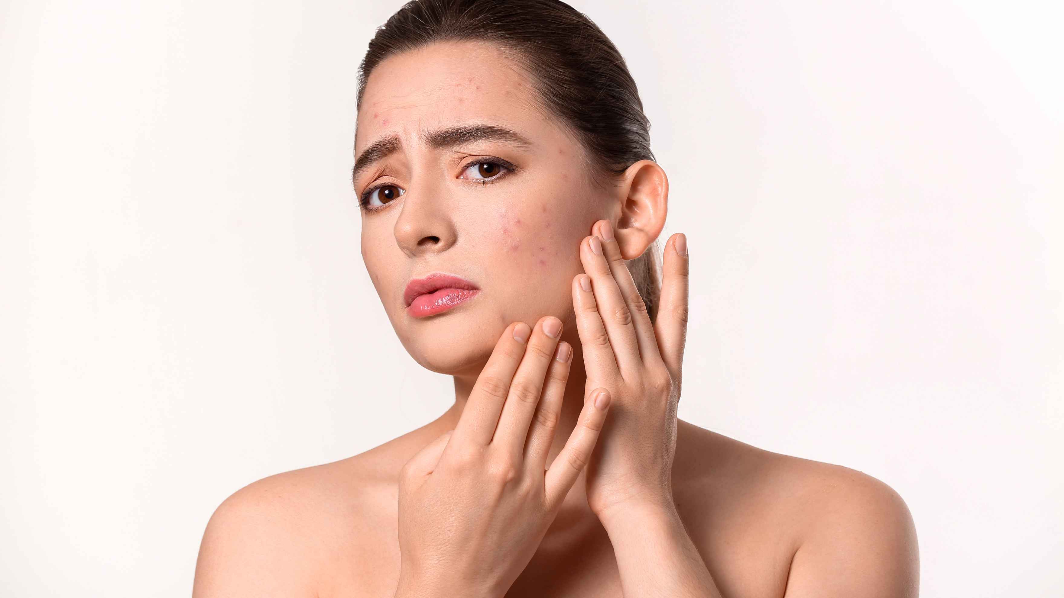 Facial Hair Might Be Contributing to Your Breakouts