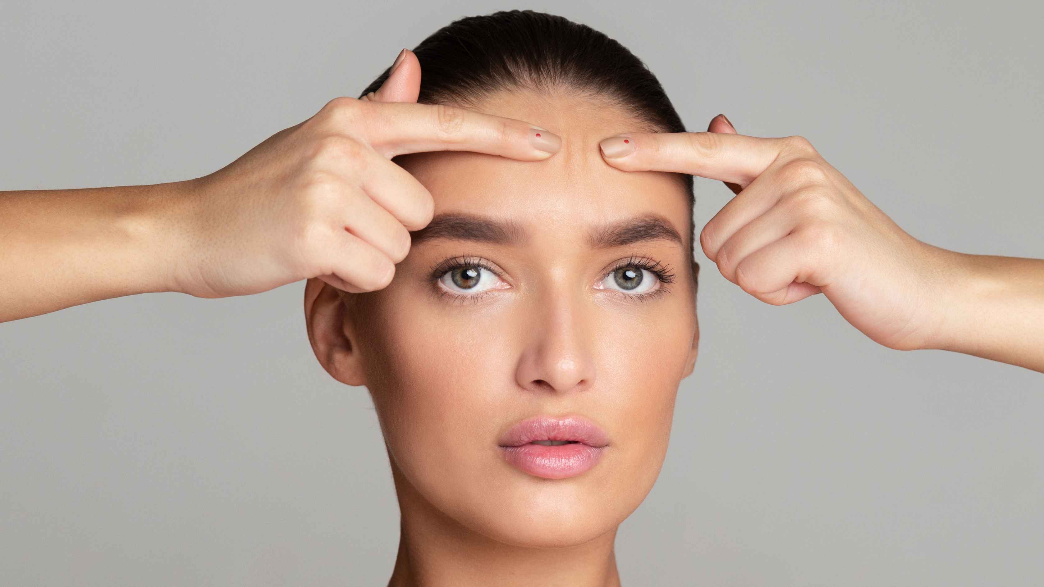 2. Treats acne