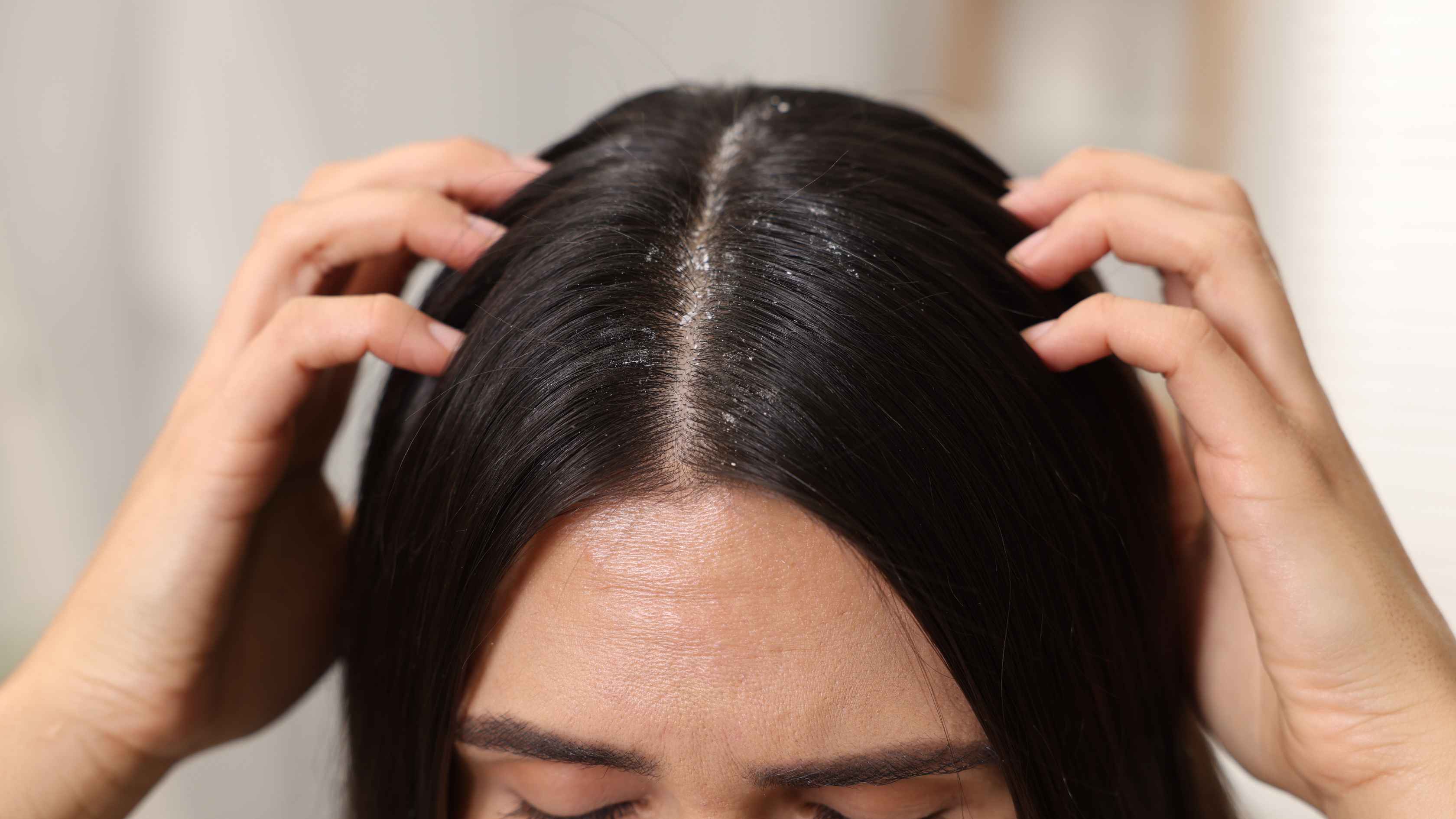6. Banishes dandruff