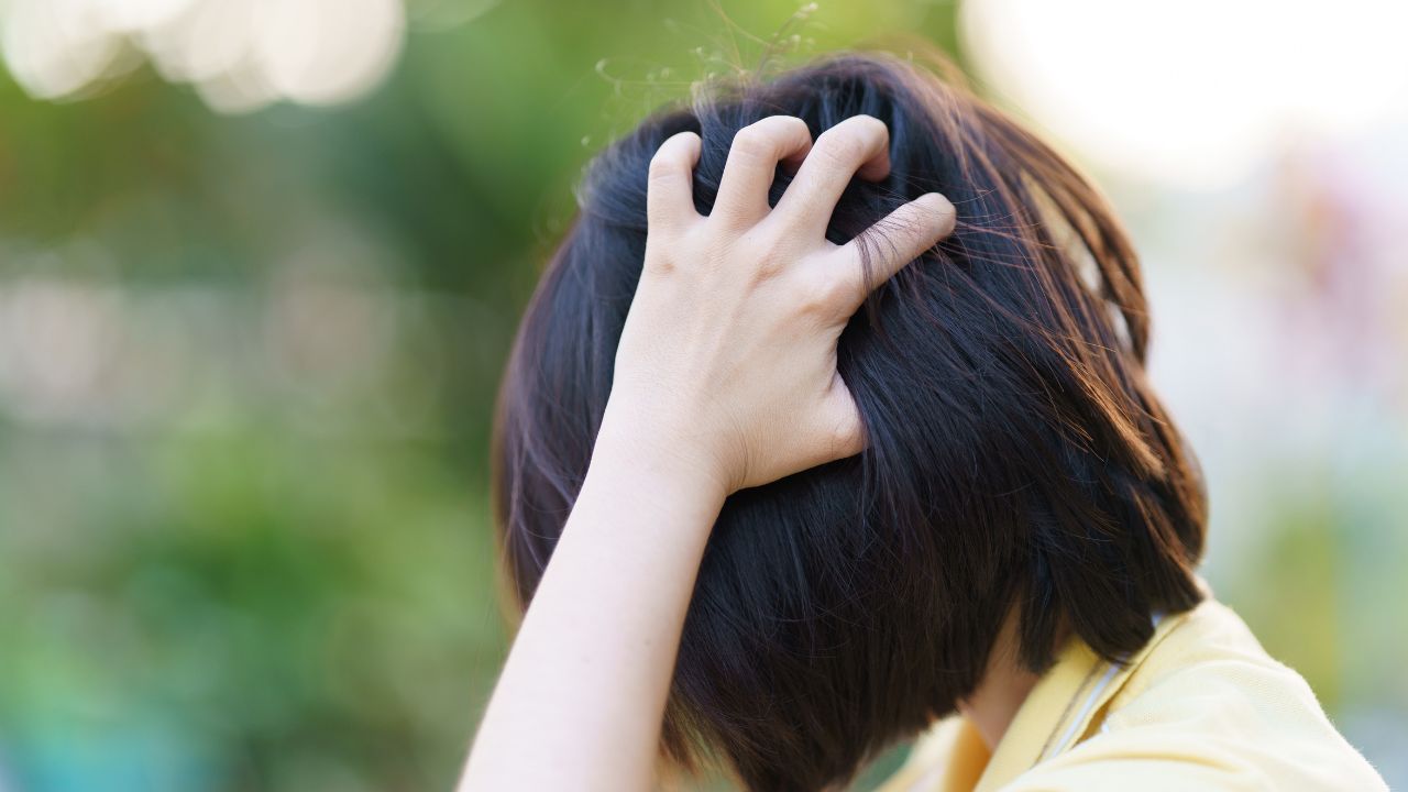 scalp infections