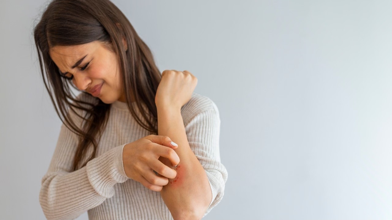 Contact dermatitis