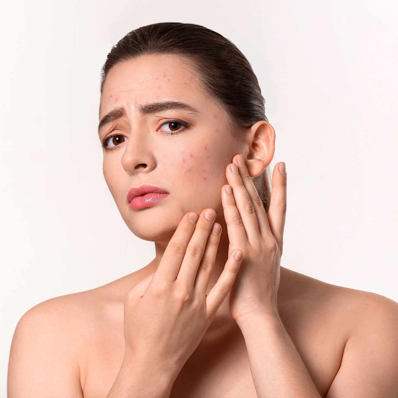 How to Prevent Acne After Swimming and Protect Your Skin 