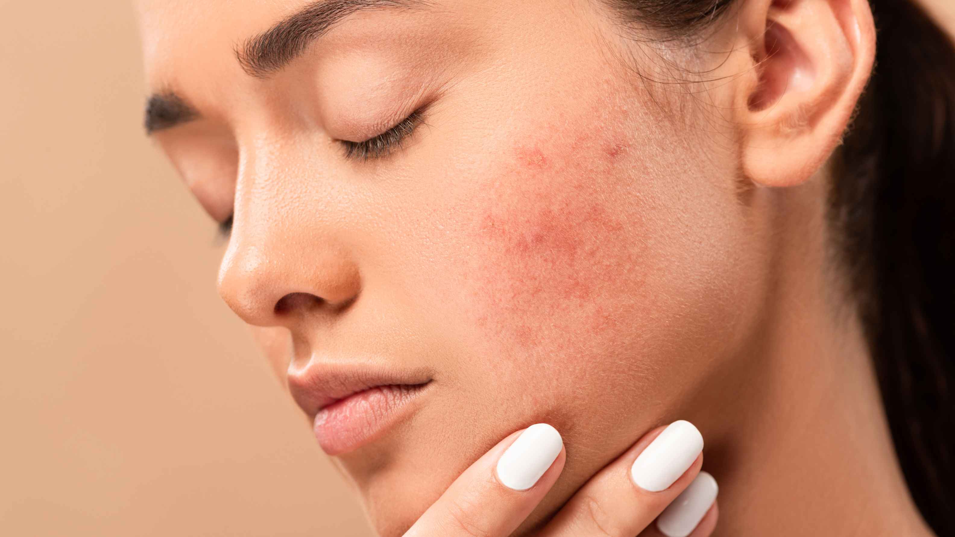 How To Heal Scabs On Face