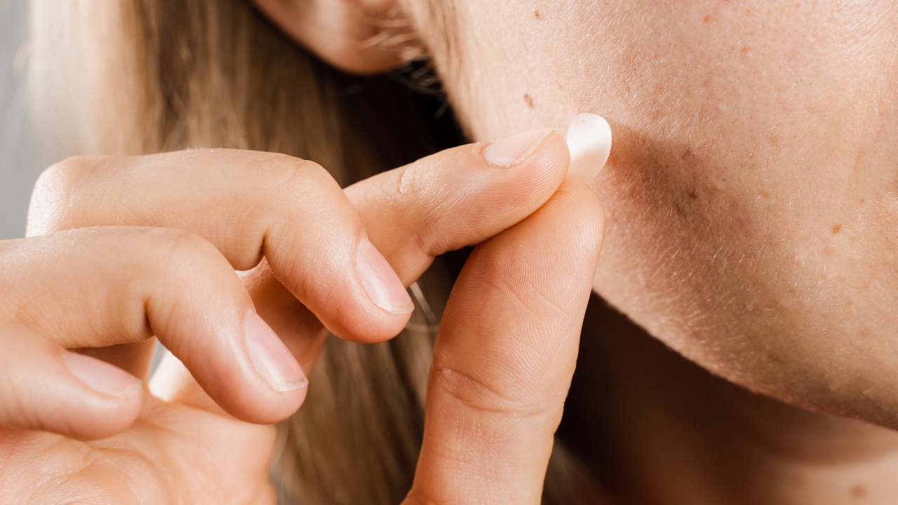 How does doxycycline treat acne?