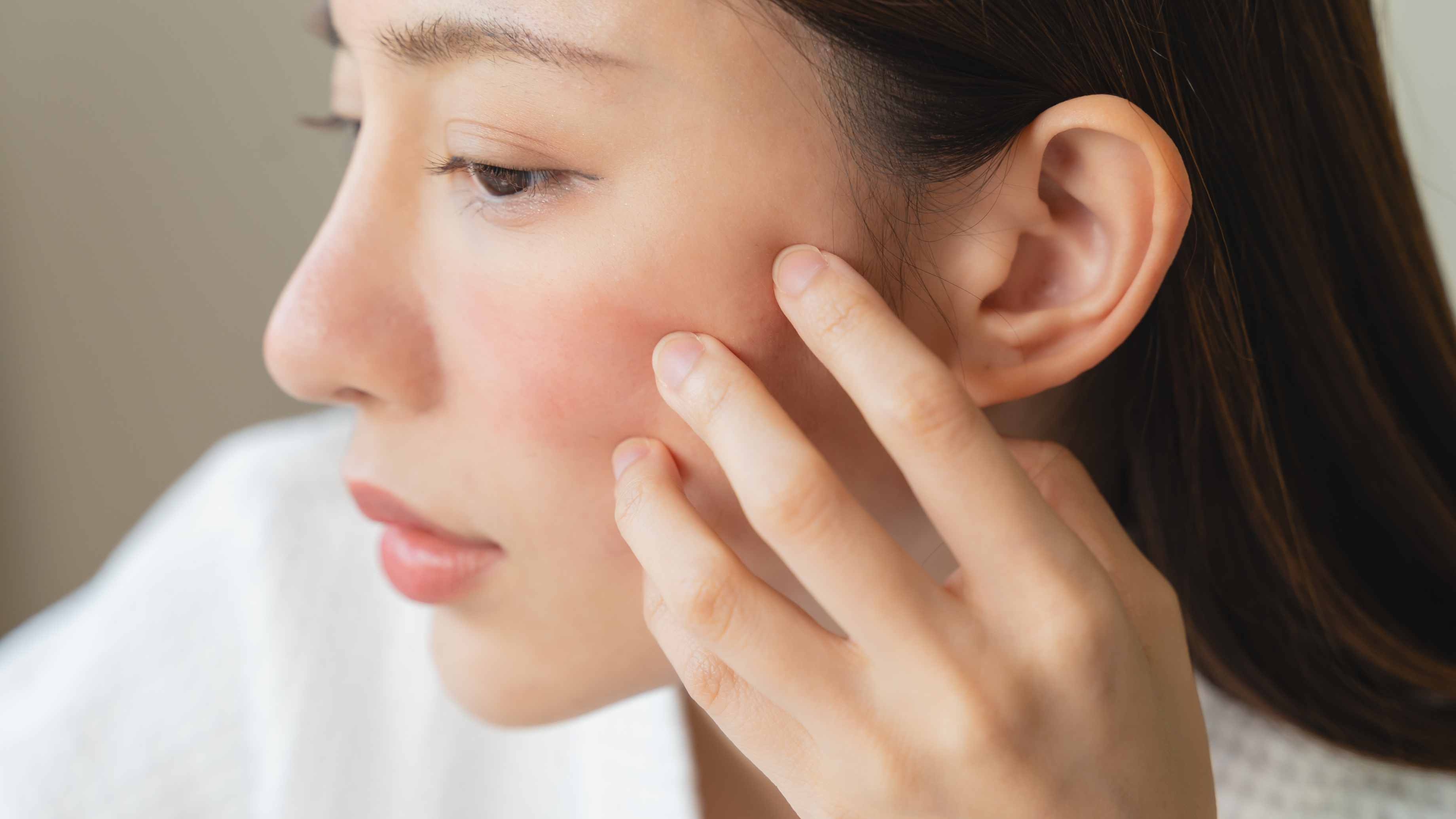How to Identify a Chemical Burn from Skincare