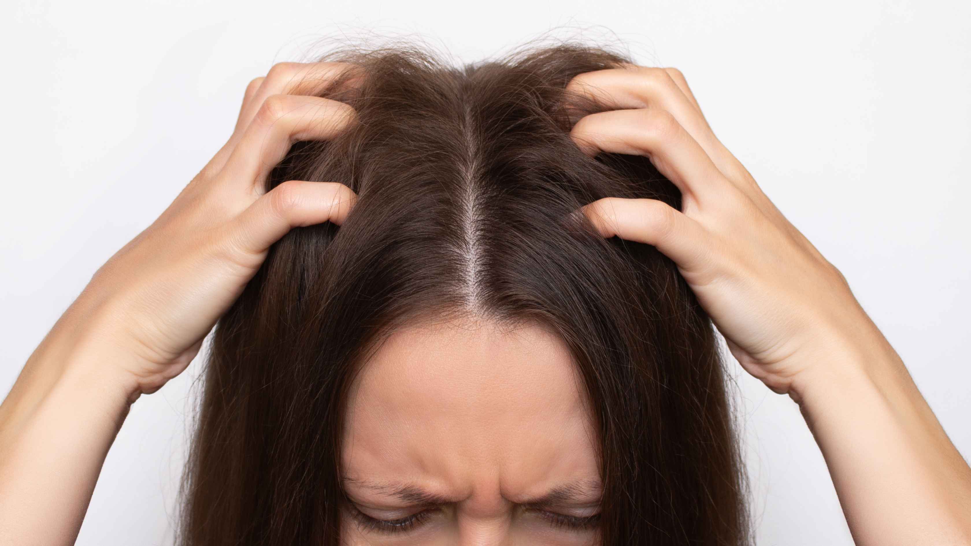 How to get rid of lice permanently