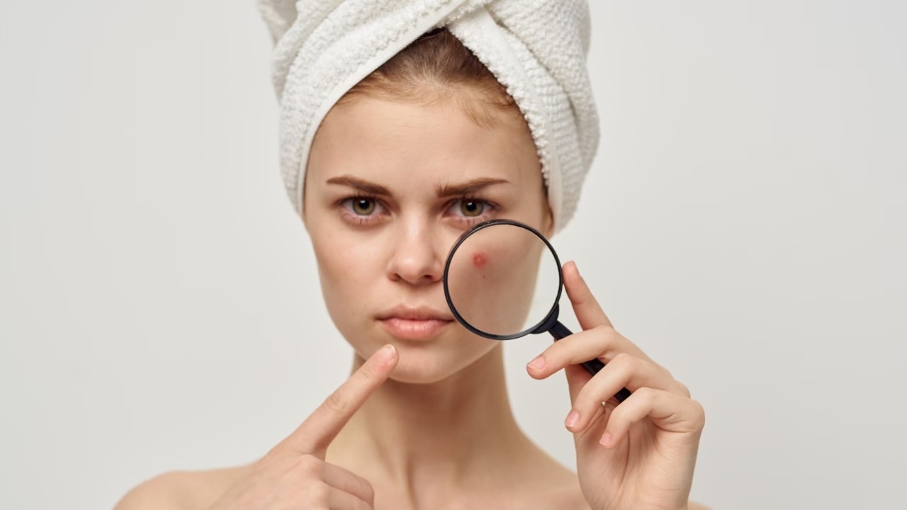 Keeps acne, pimples and blackheads at bay