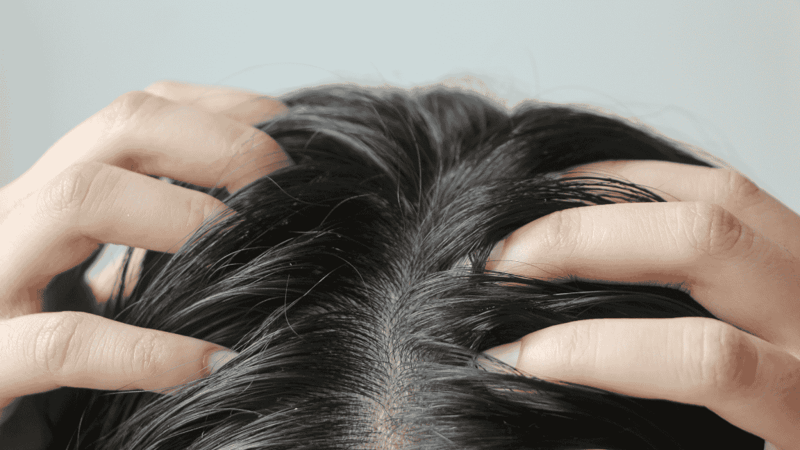 How To Get Rid Of Greasy Hair Without Having To Wash It