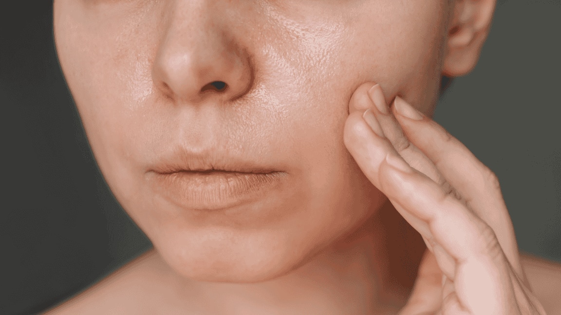Got Oily Skin? Here Are 12 Foods You Must Include In Your Diet!