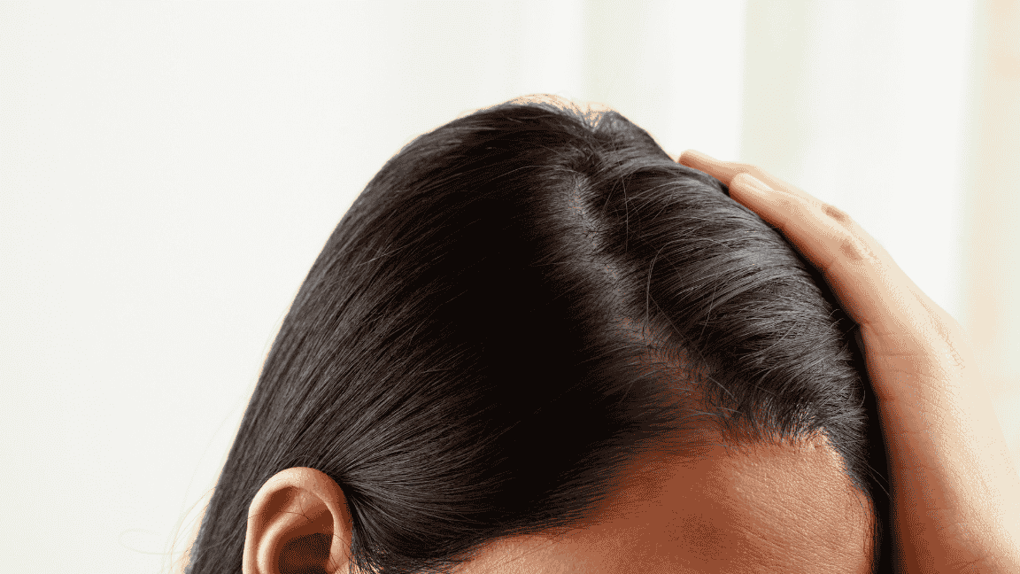 Everything You Need To Know About Dealing With An Oily Scalp