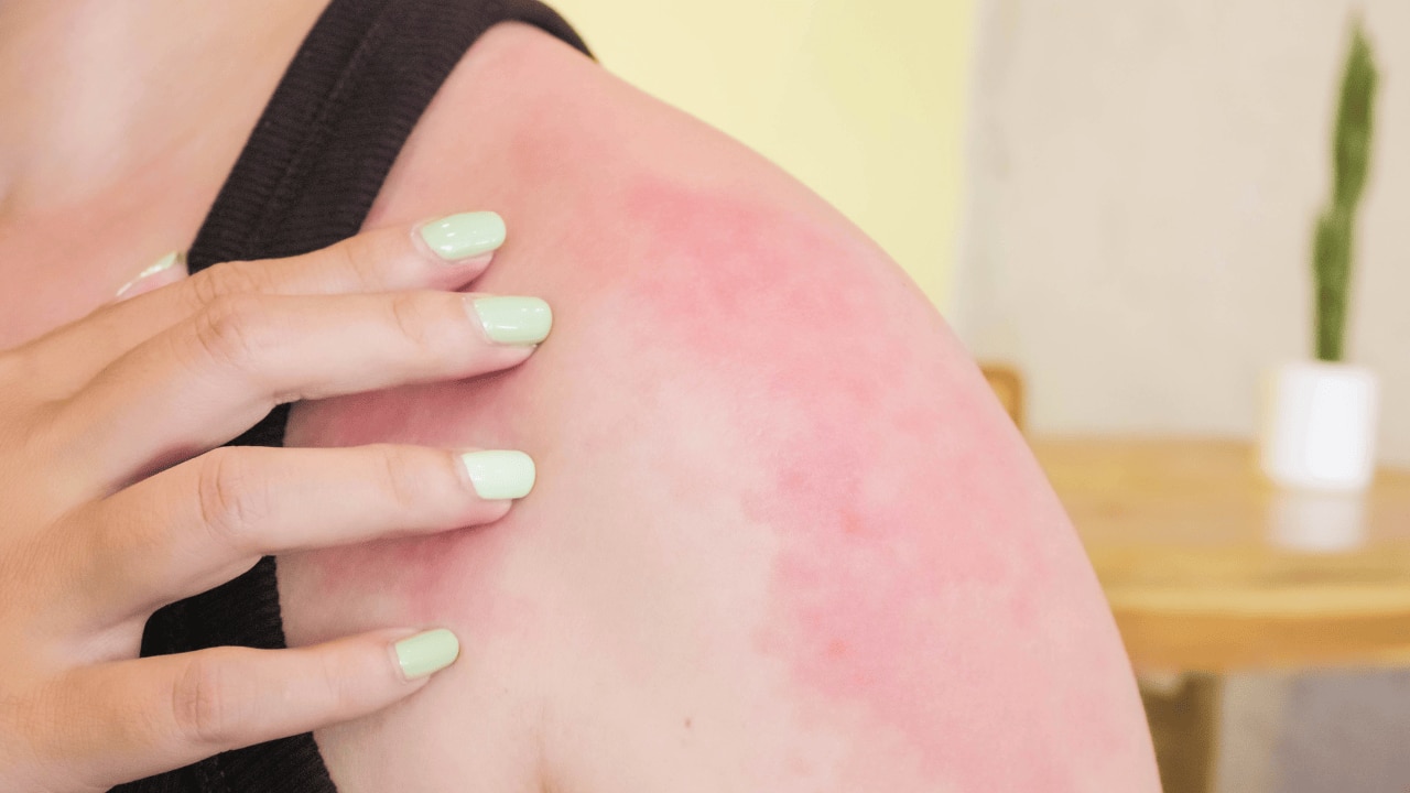 Reduces Inflammation