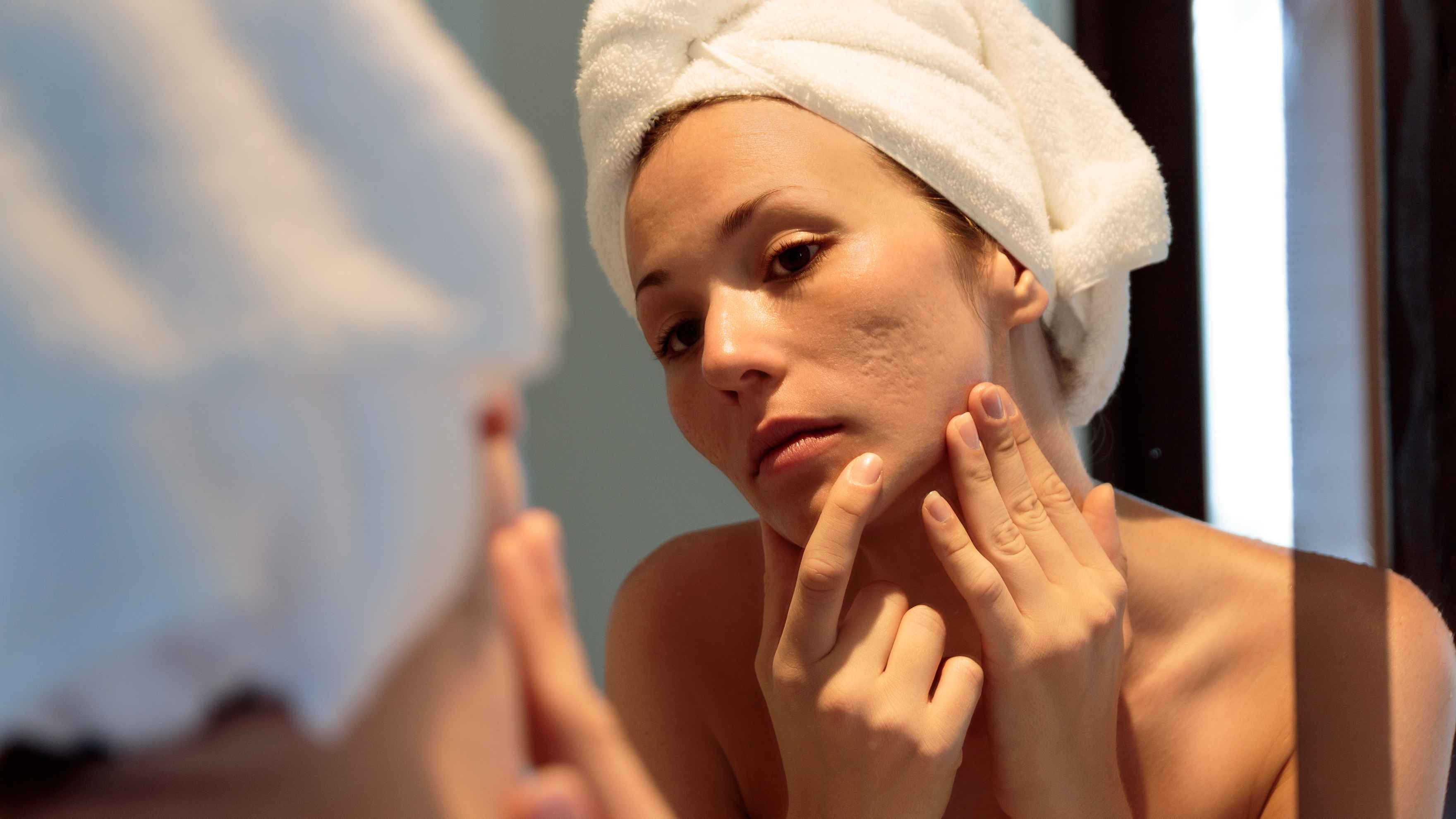 Reduces the occurrence of acne and acne scars