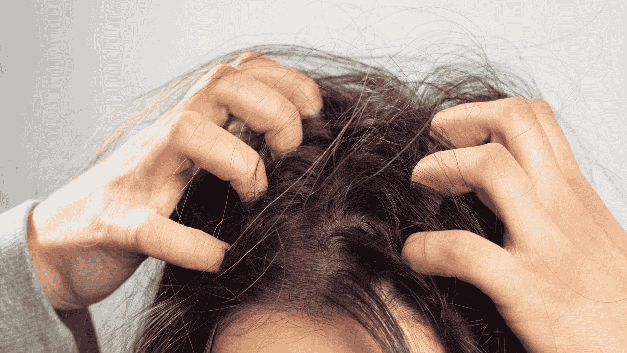 Scalp inflammation