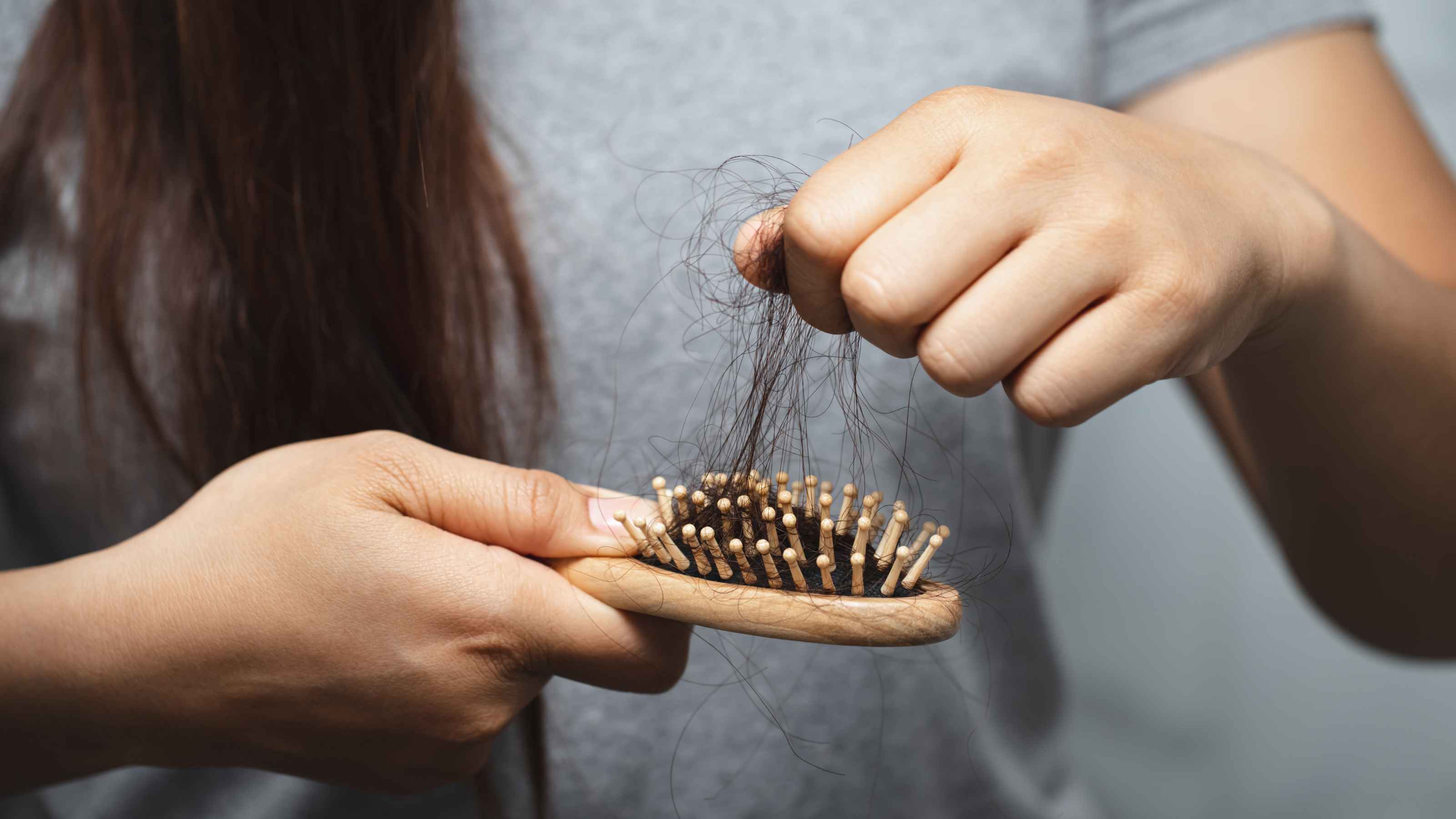 Signs and symptoms of hair fall