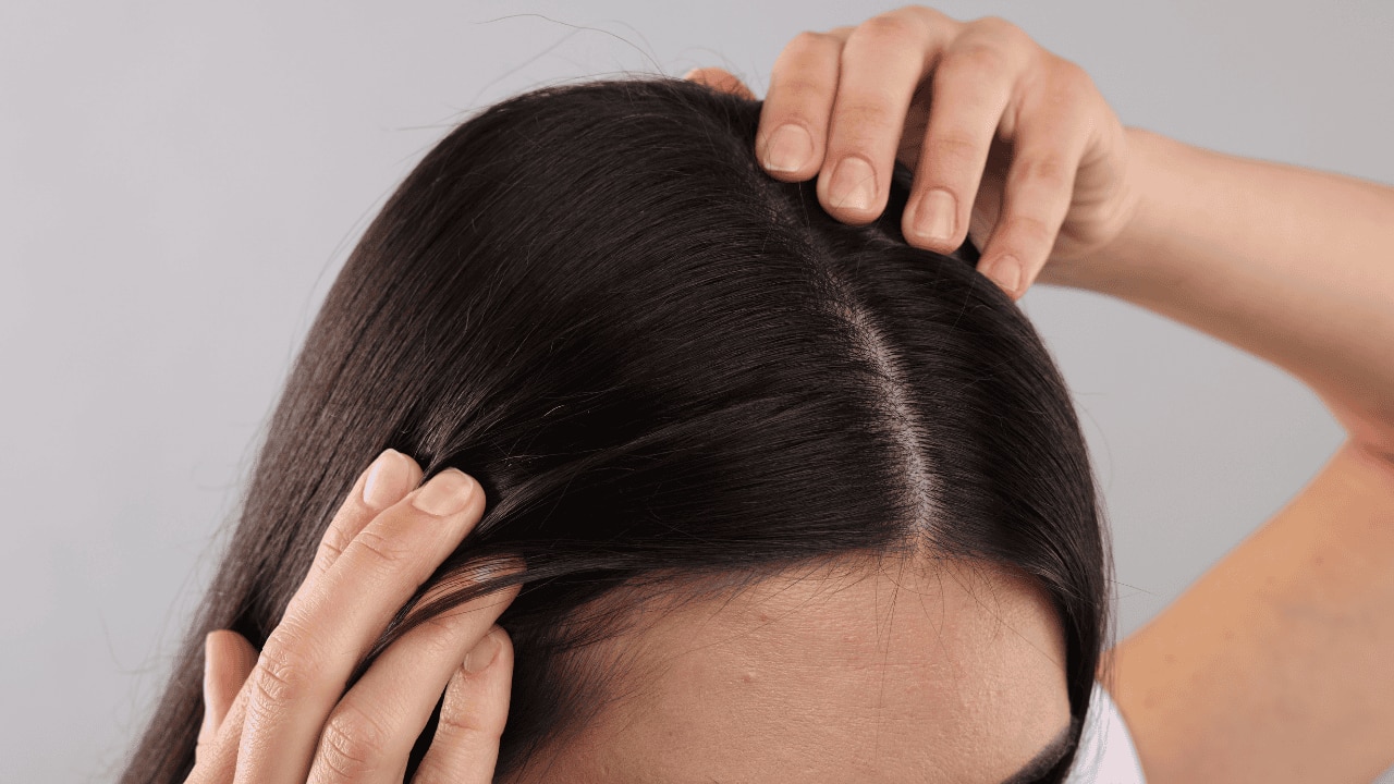 Treats dandruff and itchy scalp