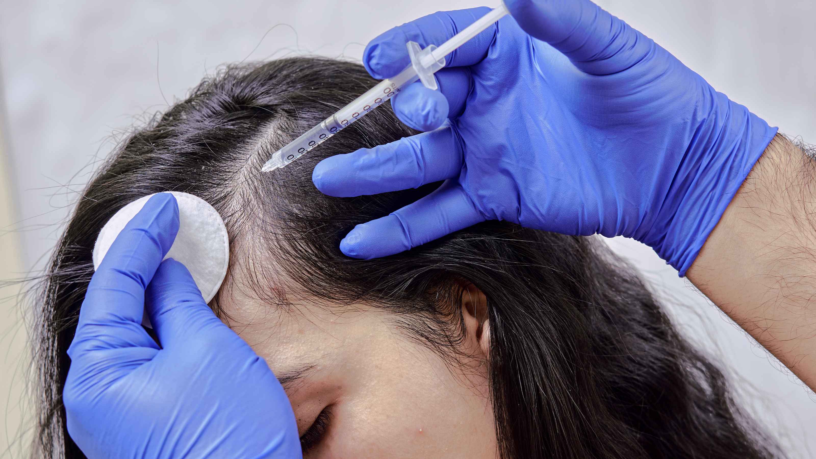 What are the advantages of mesotherapy?