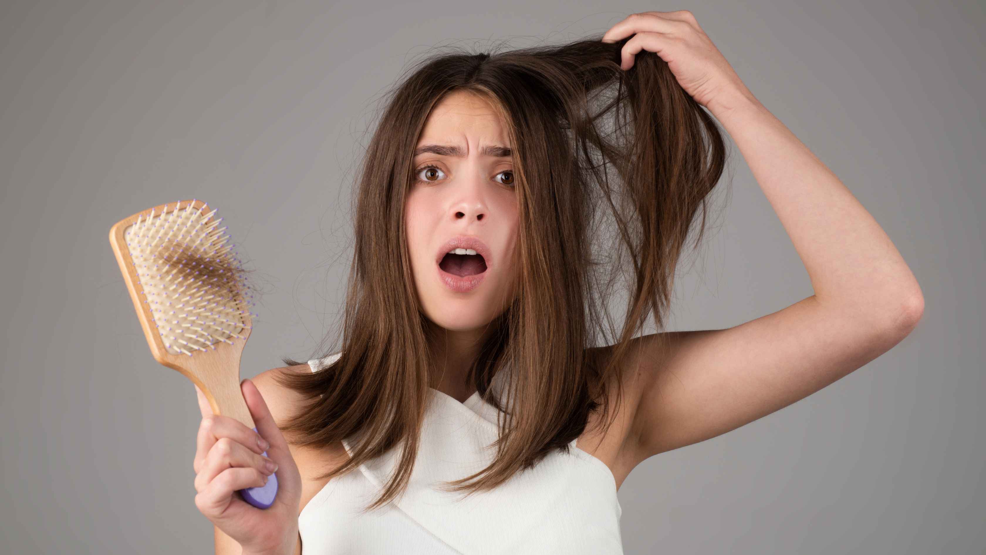 alopecia