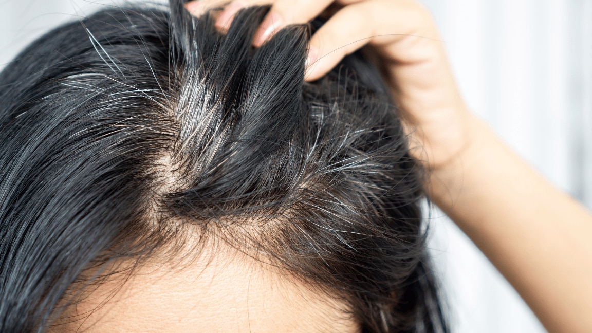 8 Home Remedies To Get Rid Of Grey Hair Naturally