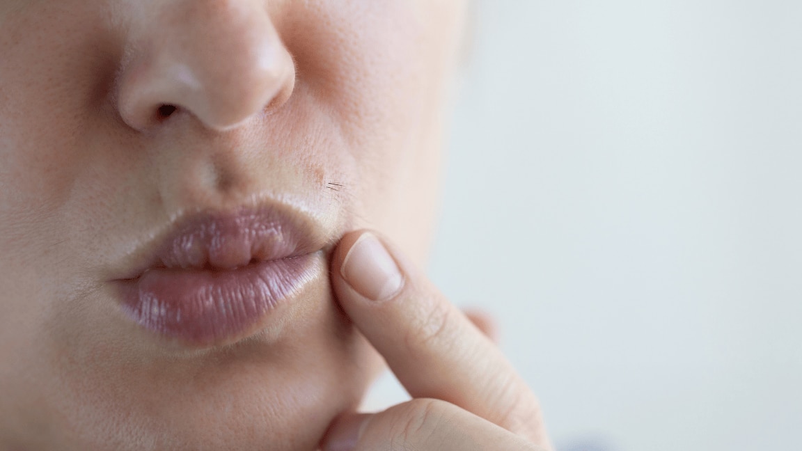 7 Easy And Natural Home Remedies To Remove Facial Hair