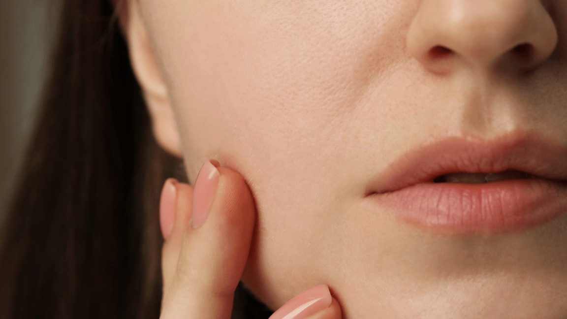Pcos Awareness: Understanding the Causes of Itchy Skin and How to Treat It