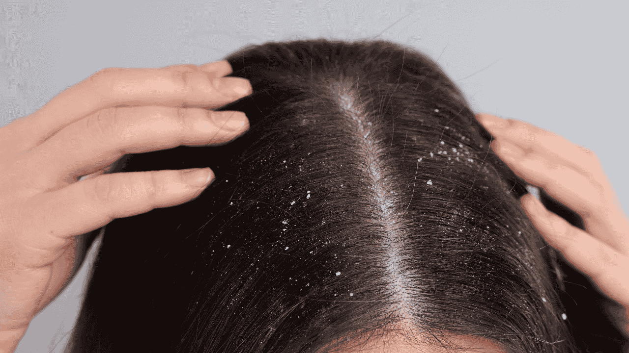 reduce flakiness