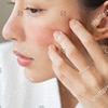 Dandruff