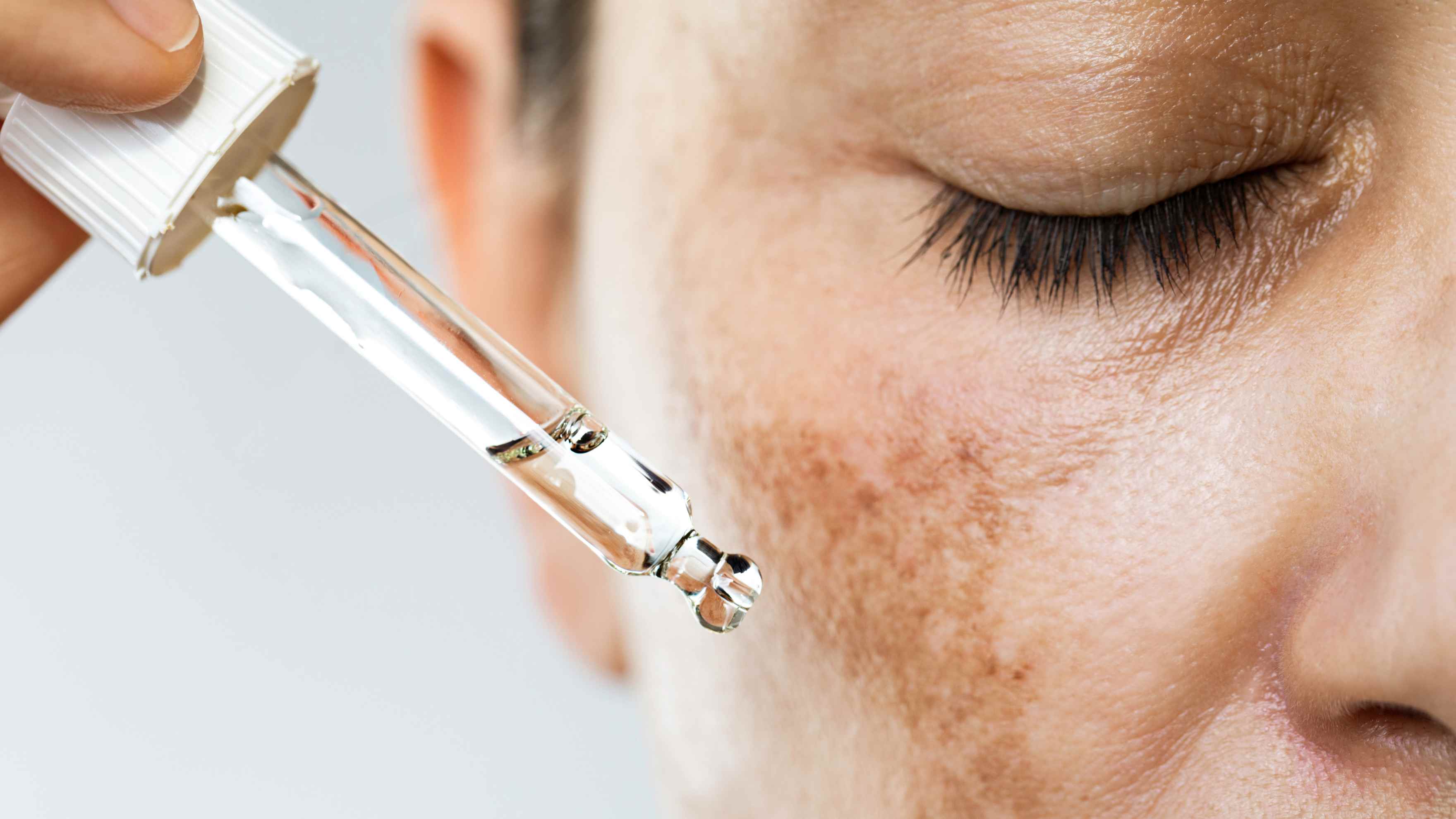 Hyperpigmentation and  Dark Spots Reduction