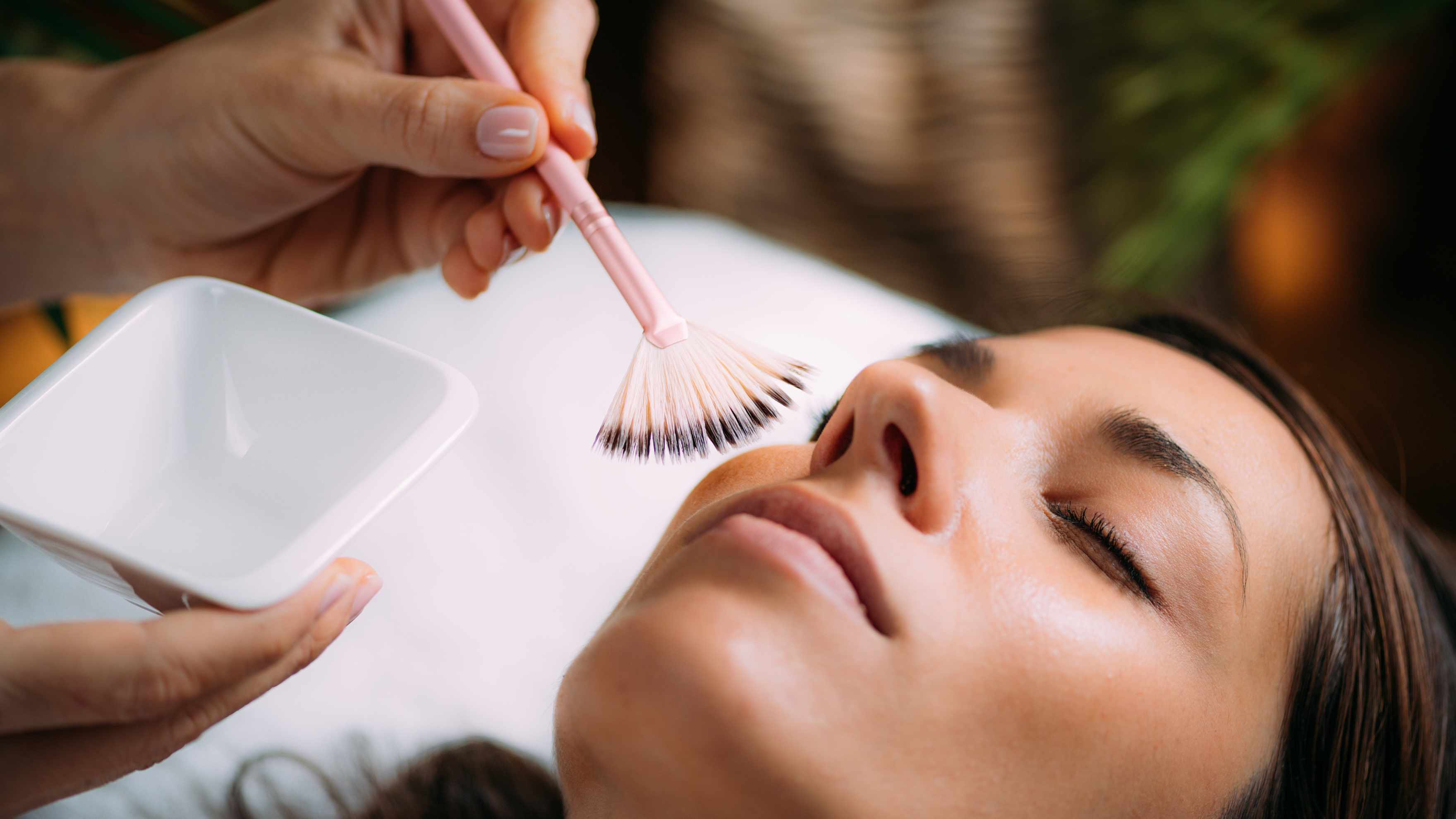 Chemical Peels