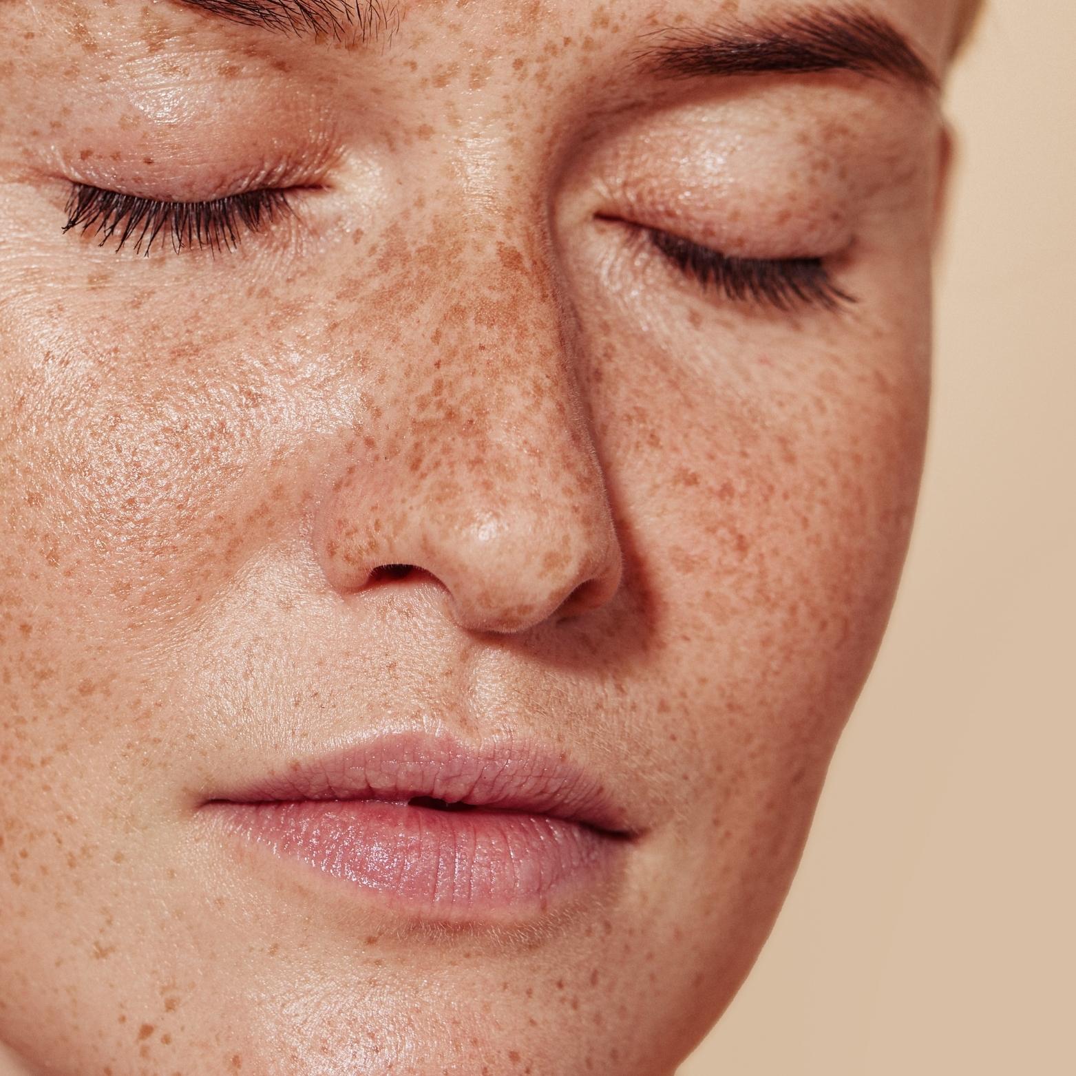 How to Reduce Melanin in Skin: Expert-Approved Tips and Treatments