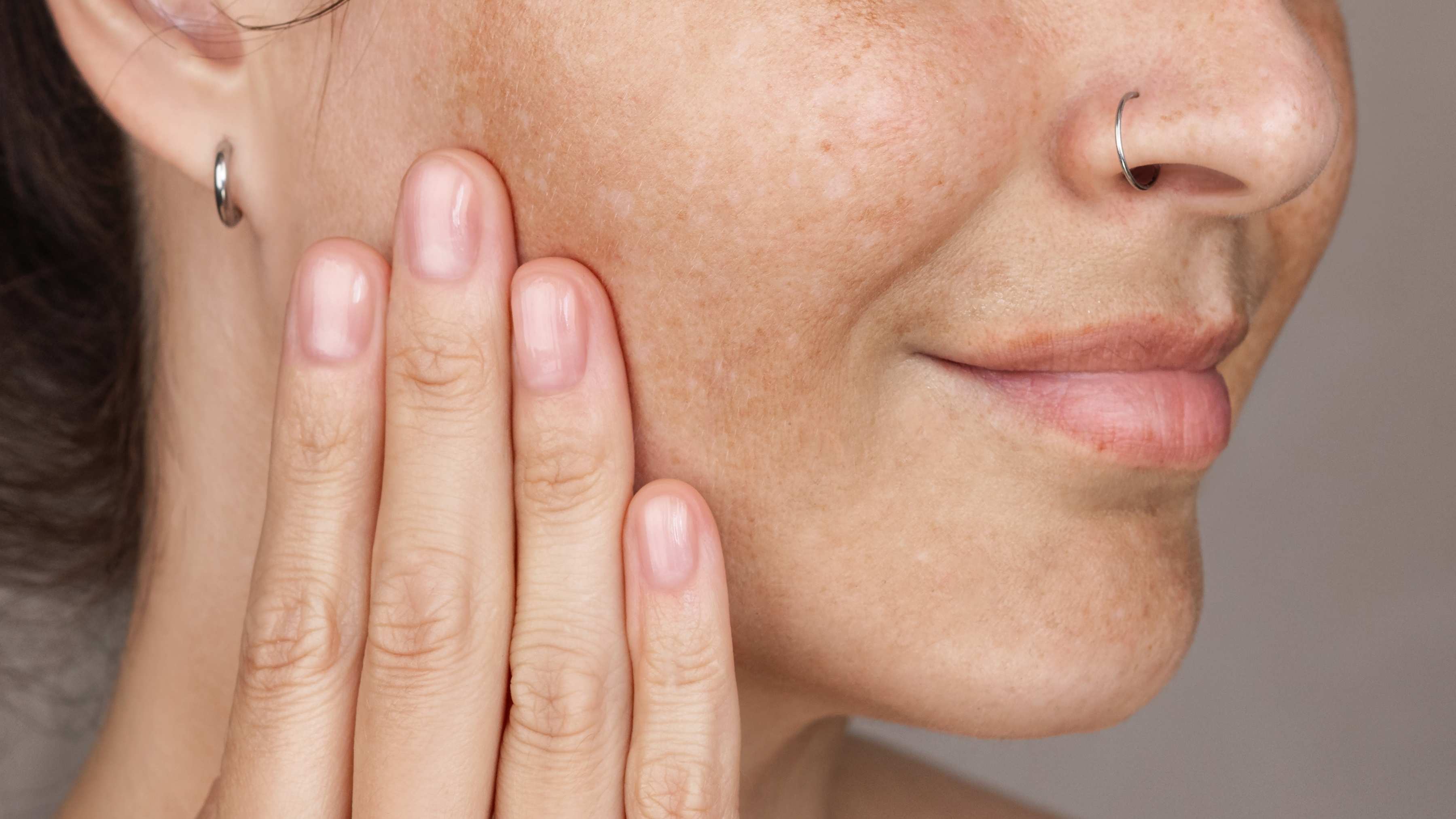 How to decrease melanin in skin