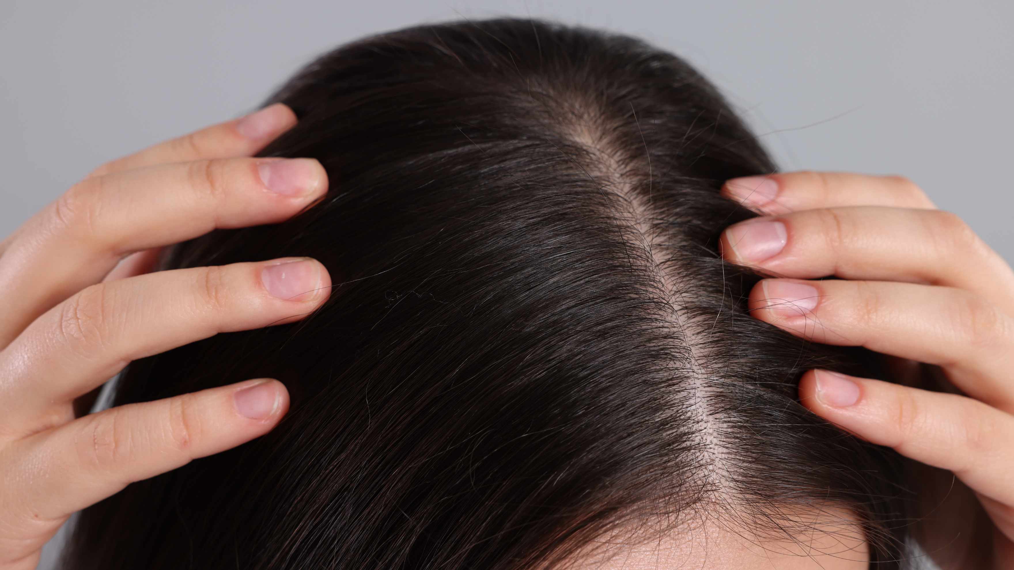 Reduces dandruff