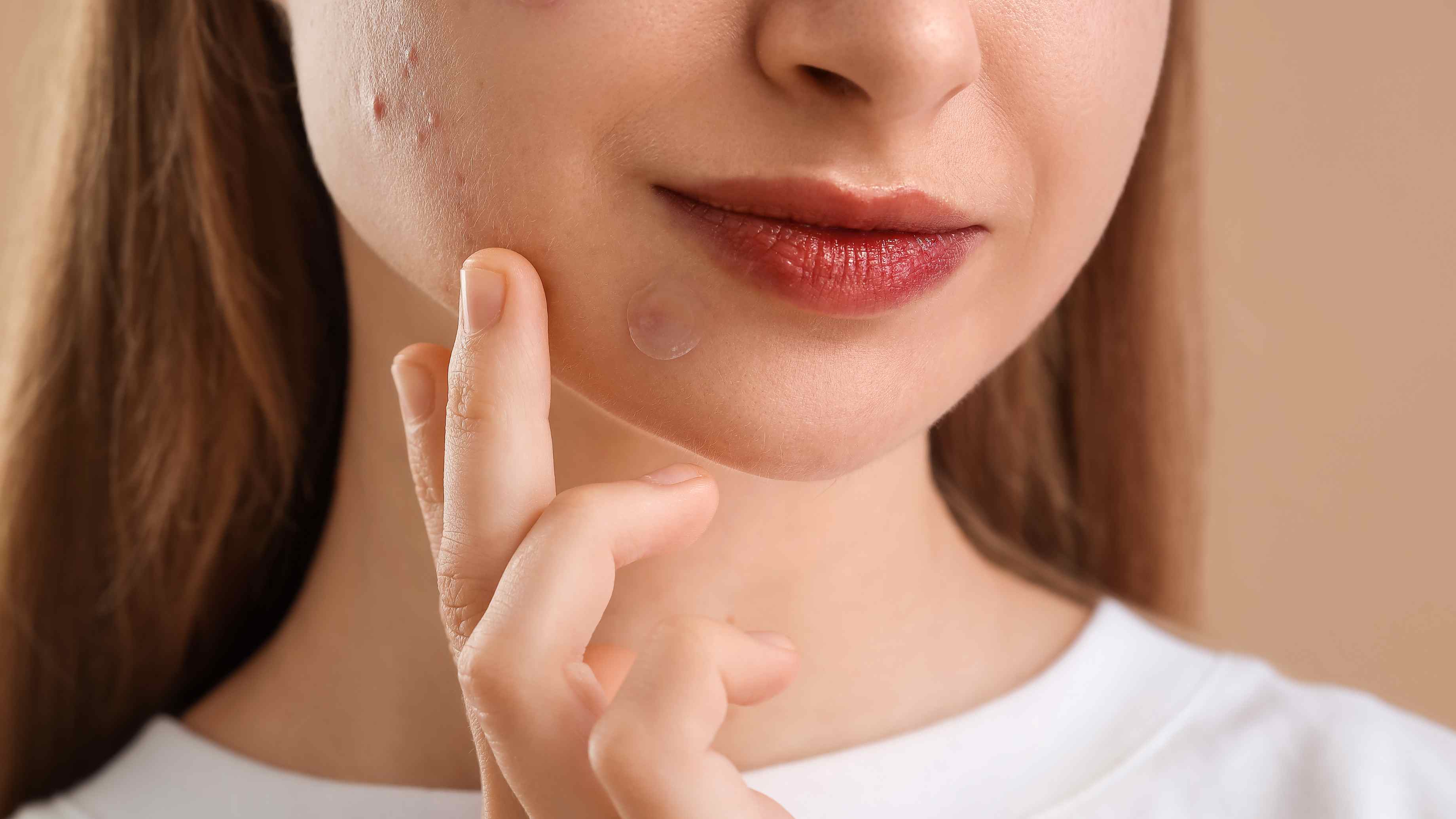 Emergency Fixes for Sudden Breakouts Before an Event