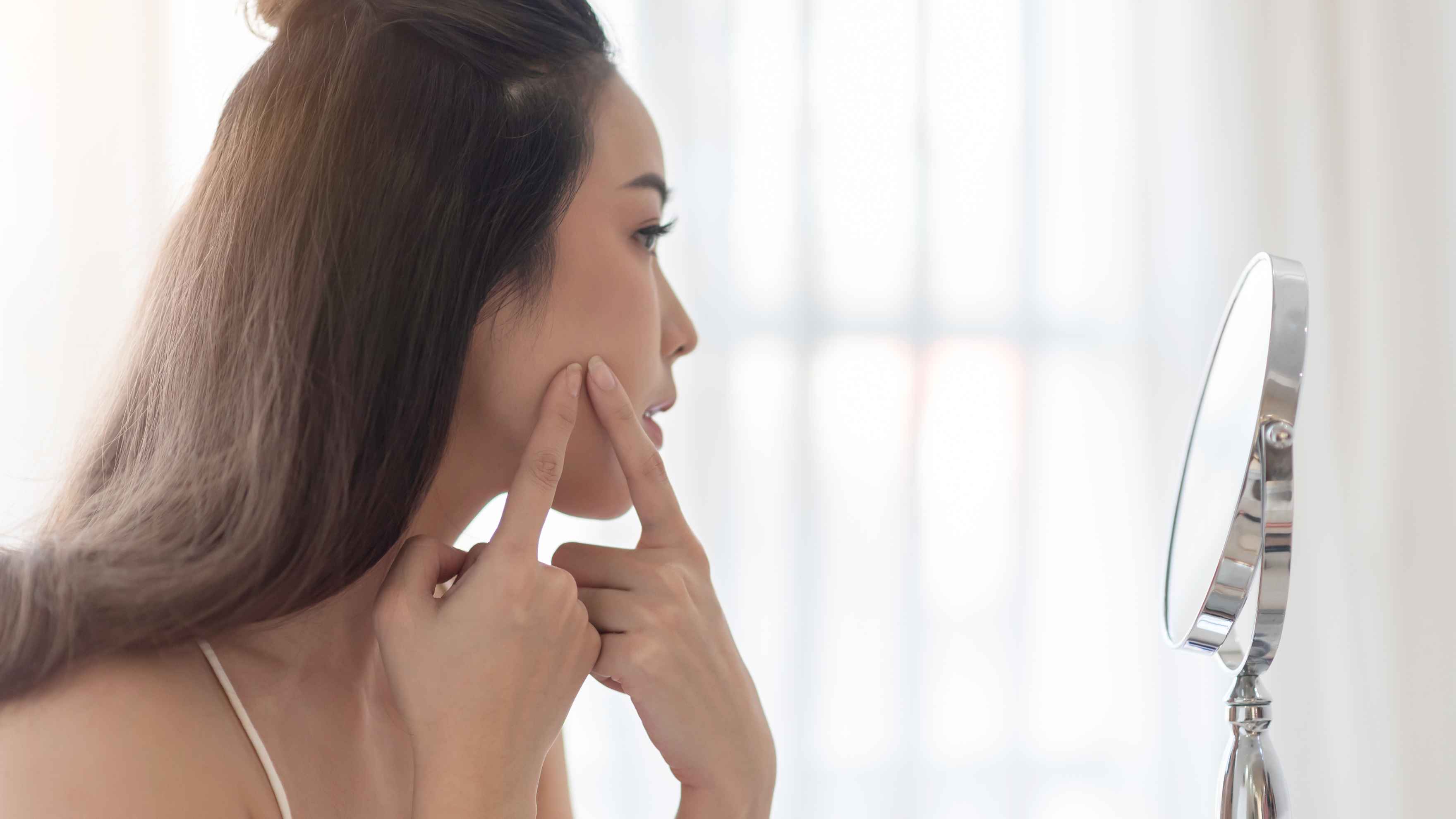 Fights acne
