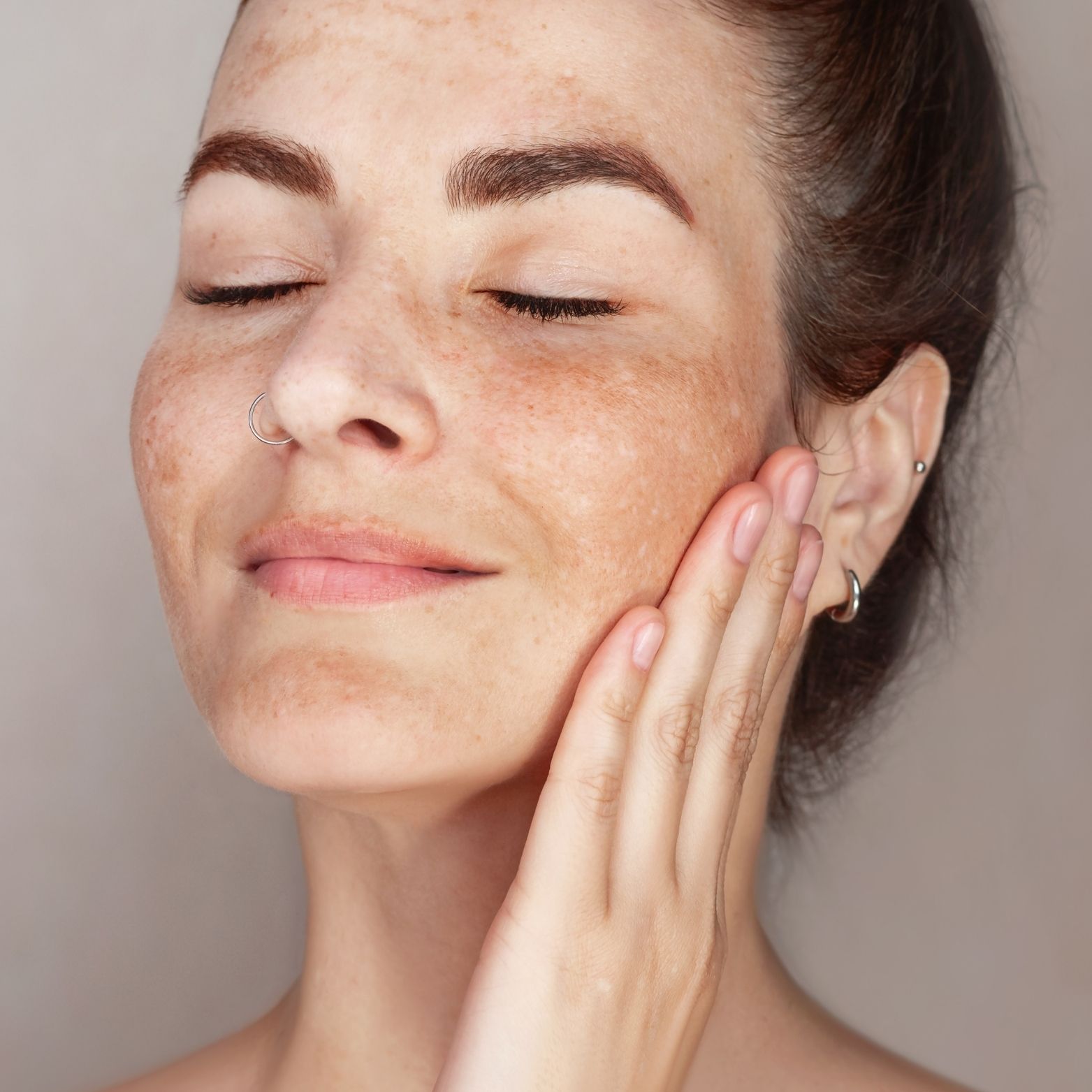 Home Remedies for Pigmentation: Natural Ways to Remove Dark Spots Permanently