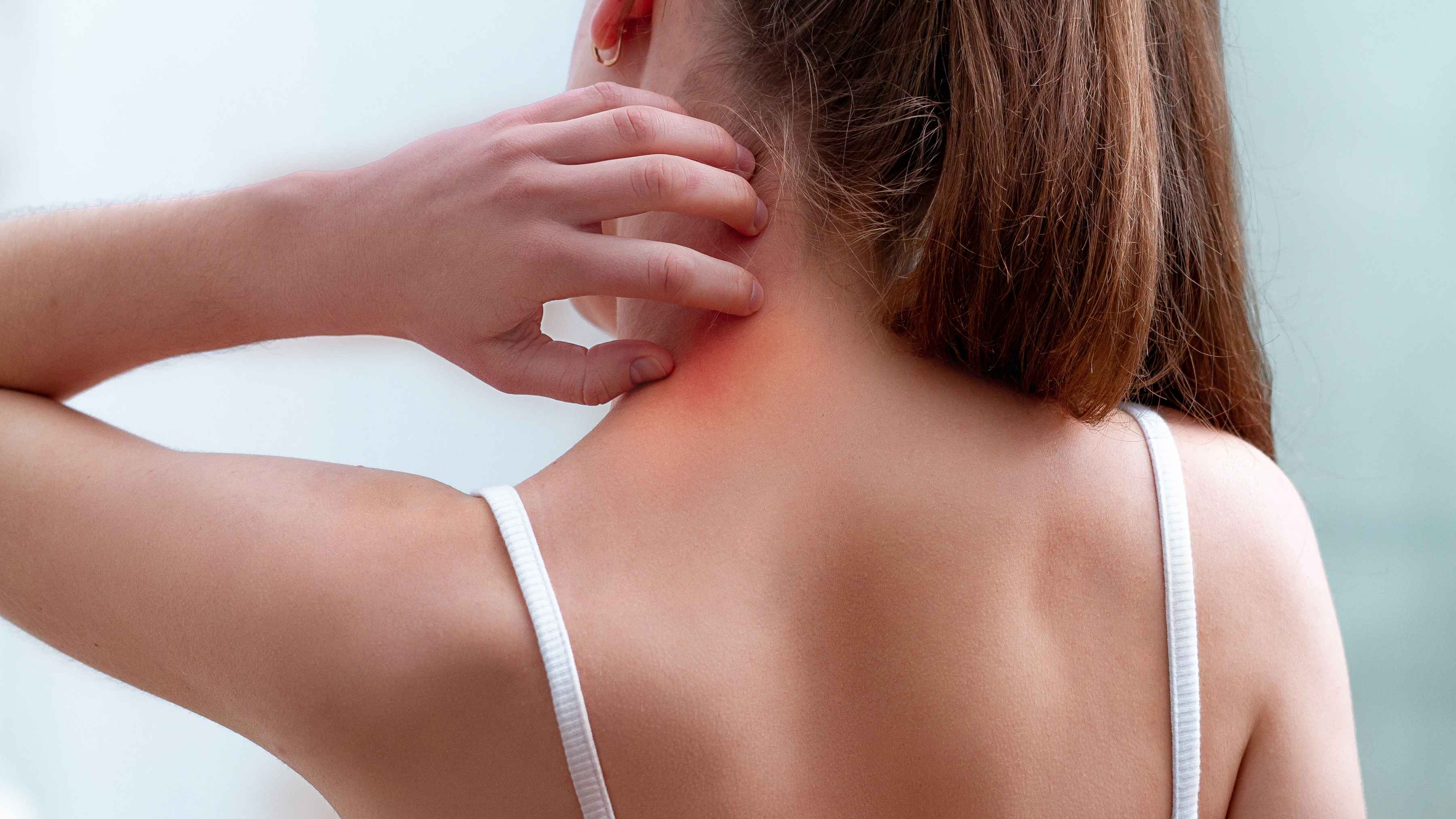 Home-remedies-for-fungal-infection-on-skin