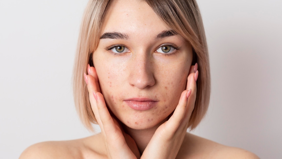 how to remove black spots on face