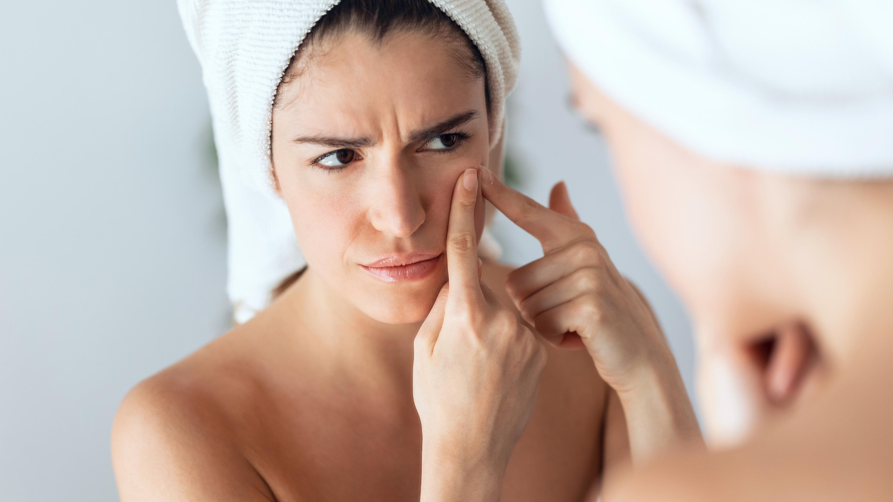 How to remove pimples overnight - Dermatologist approved treatments