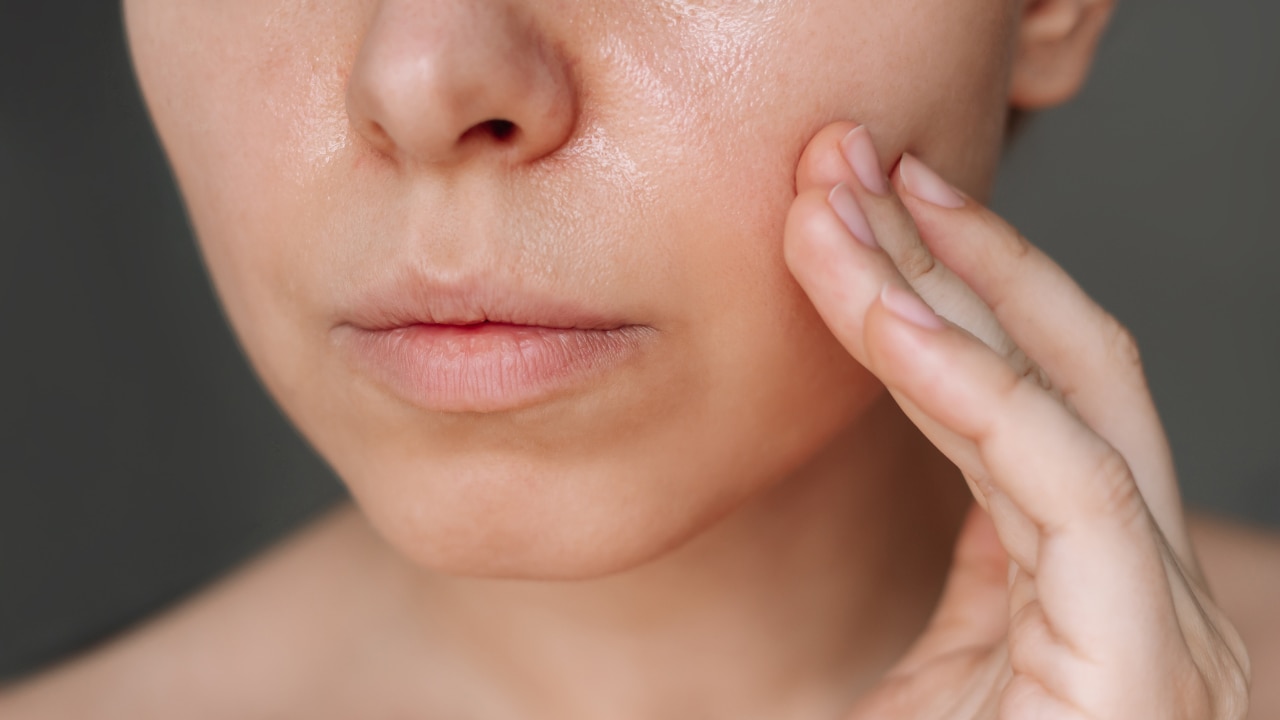 Niacinamide for Pigmentation & Dark Spots