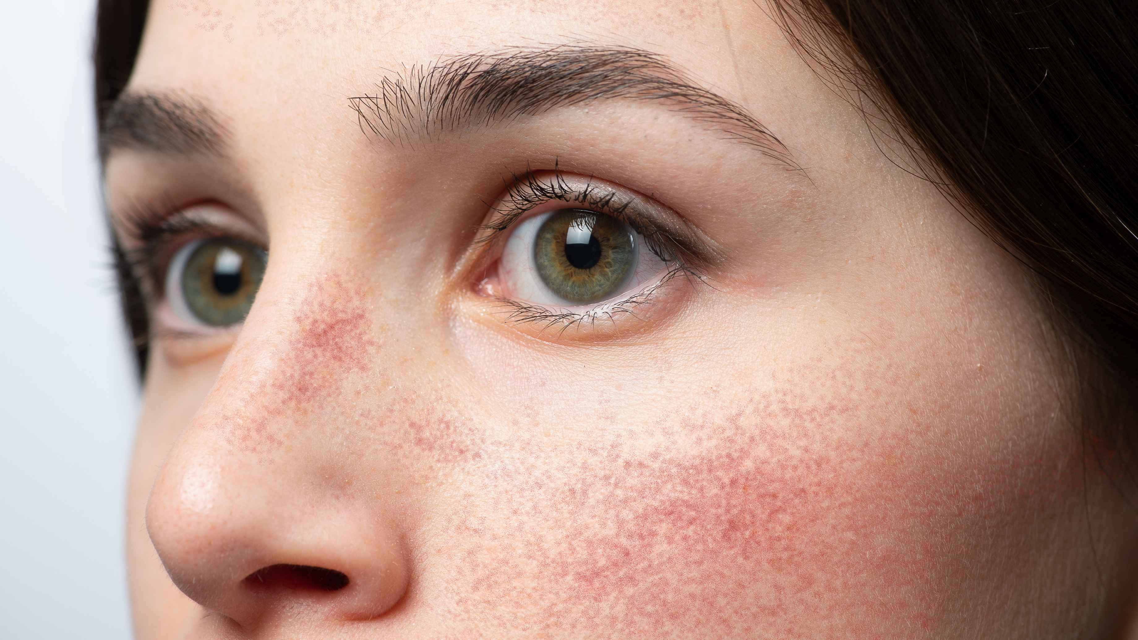 Glycolic Acid Side Effects & How to Use It Safely