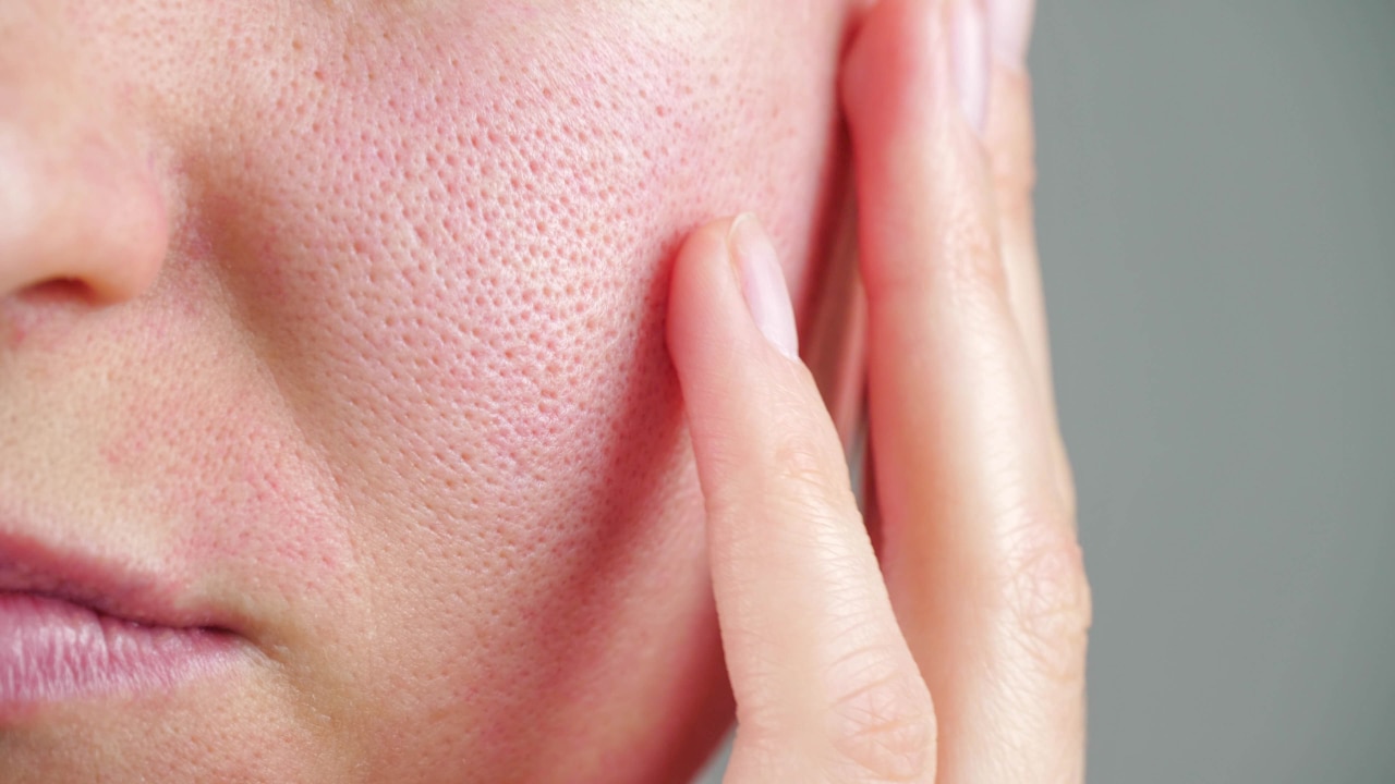 Minimizes Pores